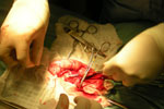 Application of Haemostat